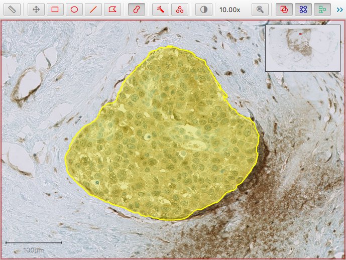 Annotated region