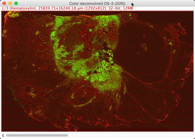 imagej make selection from threshold