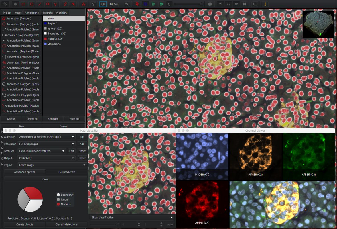 Pixel classification thick boundaries