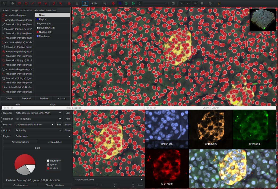 Pixel classification thin boundaries