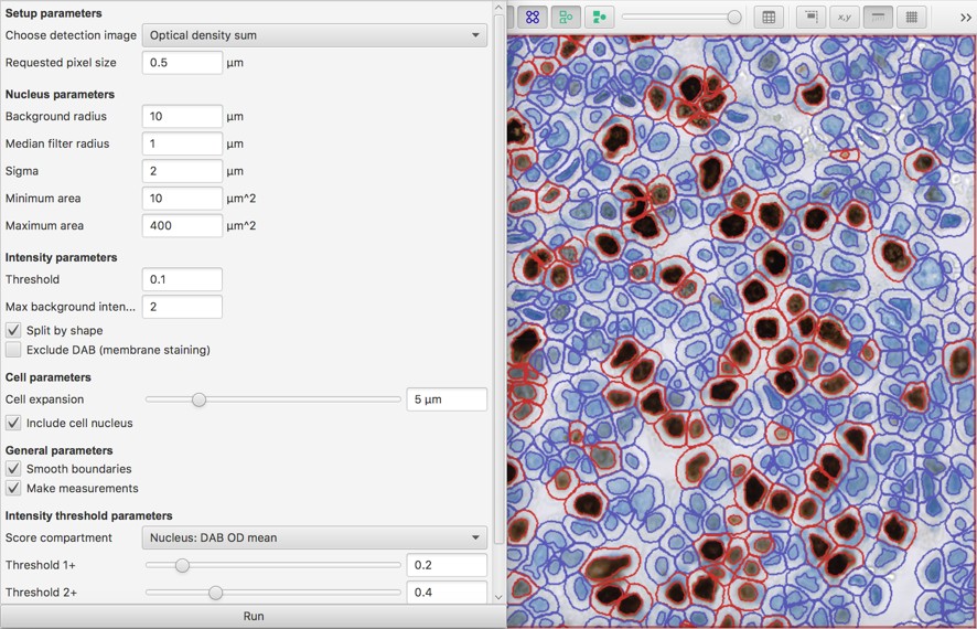 Positive cell detection